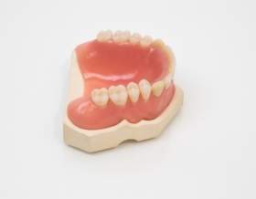Несъемные протезы - зубные мосты